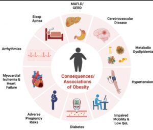 Health risks associated with high BMI including diabetes and heart diseas