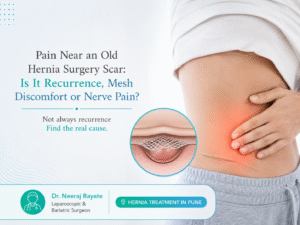 hernia-treatment