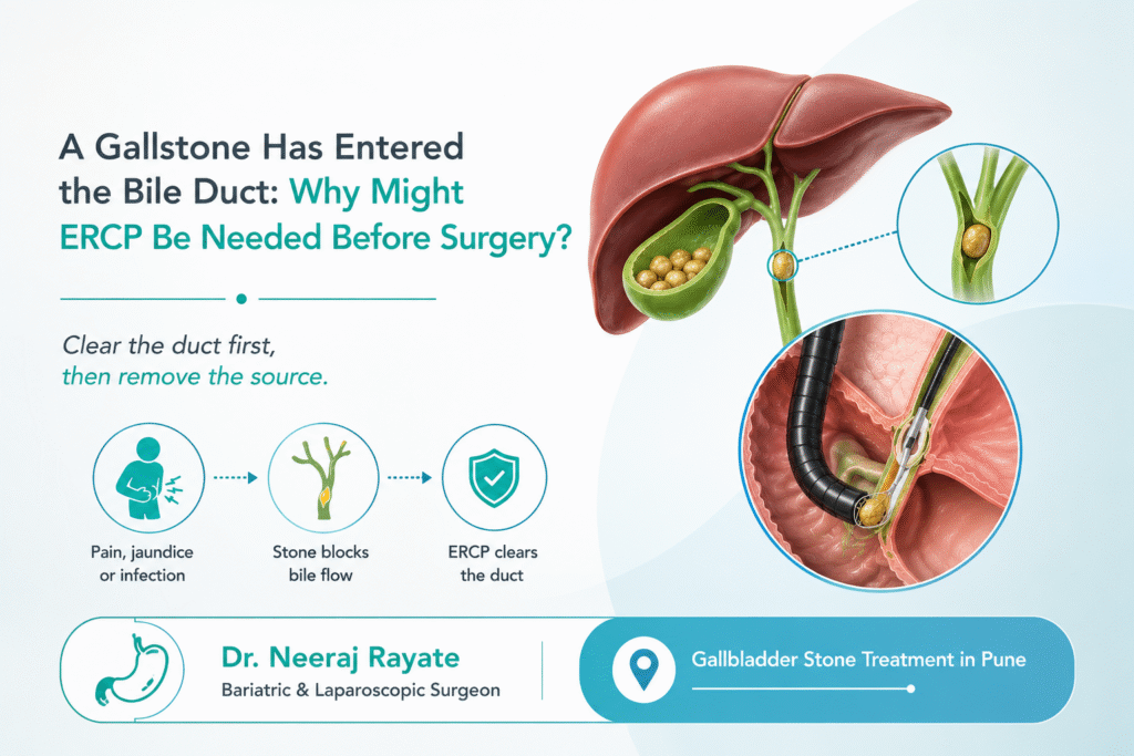 Gallbladder Stone Treatment in Pune